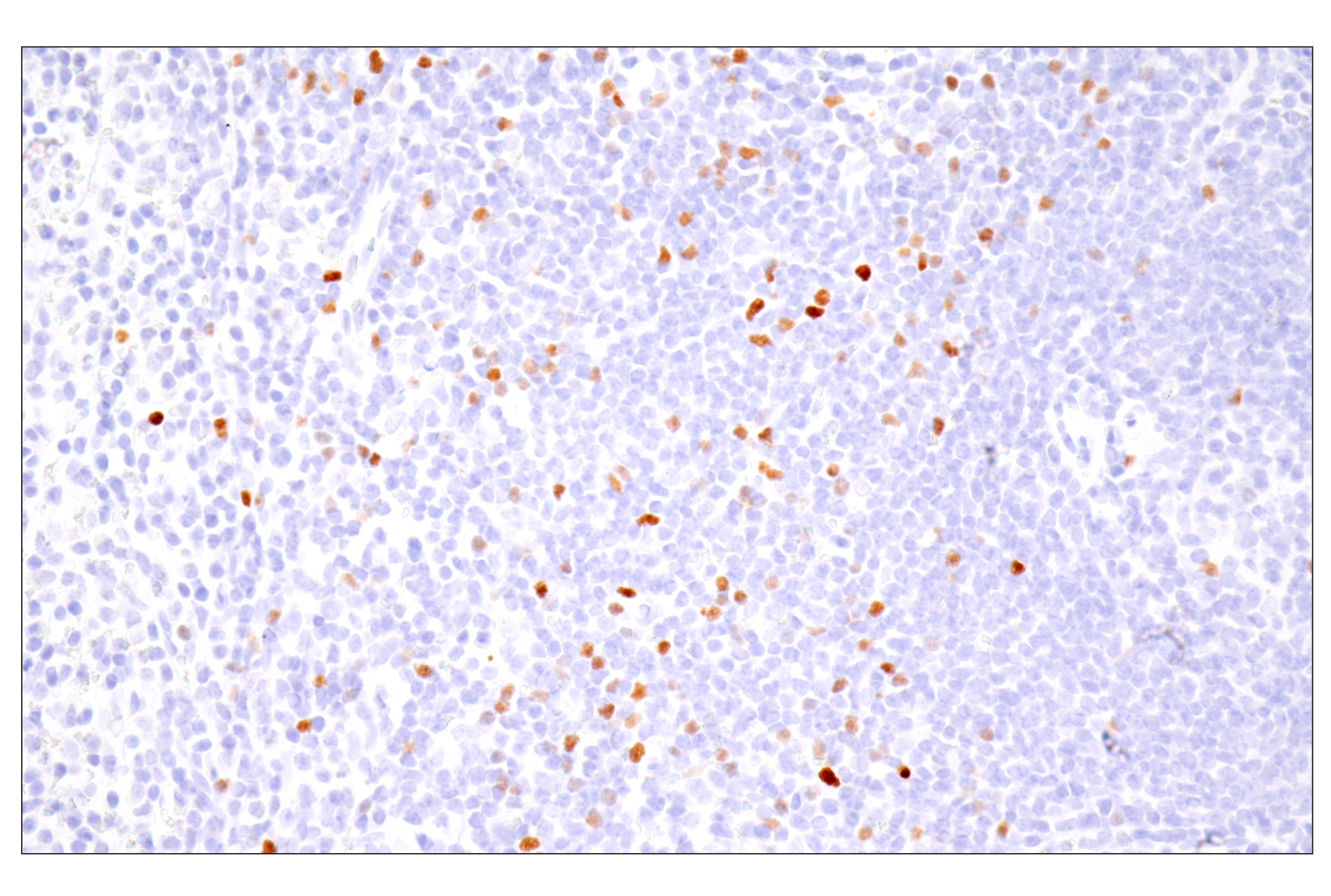 Immunohistochemistry Image 6: FoxP3 (D6O8R) Rabbit mAb (BSA and Azide Free)