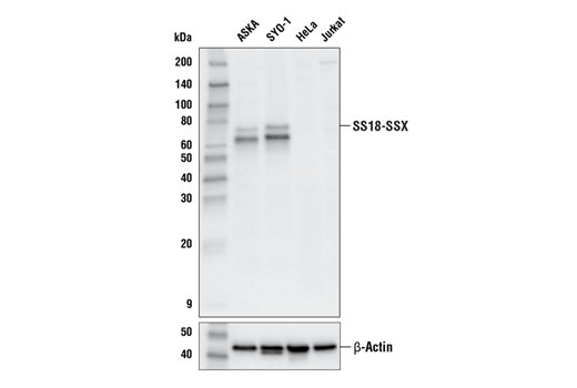  Image 12: BAF Complex IHC Antibody Sampler Kit