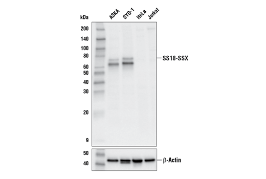 Western Blotting Image 1: SS18-SSX (E9X9V) XP® Rabbit mAb