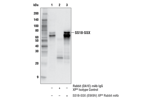 Immunoprecipitation Image 1: SS18-SSX (E9X9V) XP® Rabbit mAb