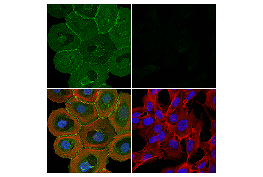 Immunofluorescence Image 1: TACSTD2/TROP2 (E8Y8S) Rabbit mAb (BSA and Azide Free)