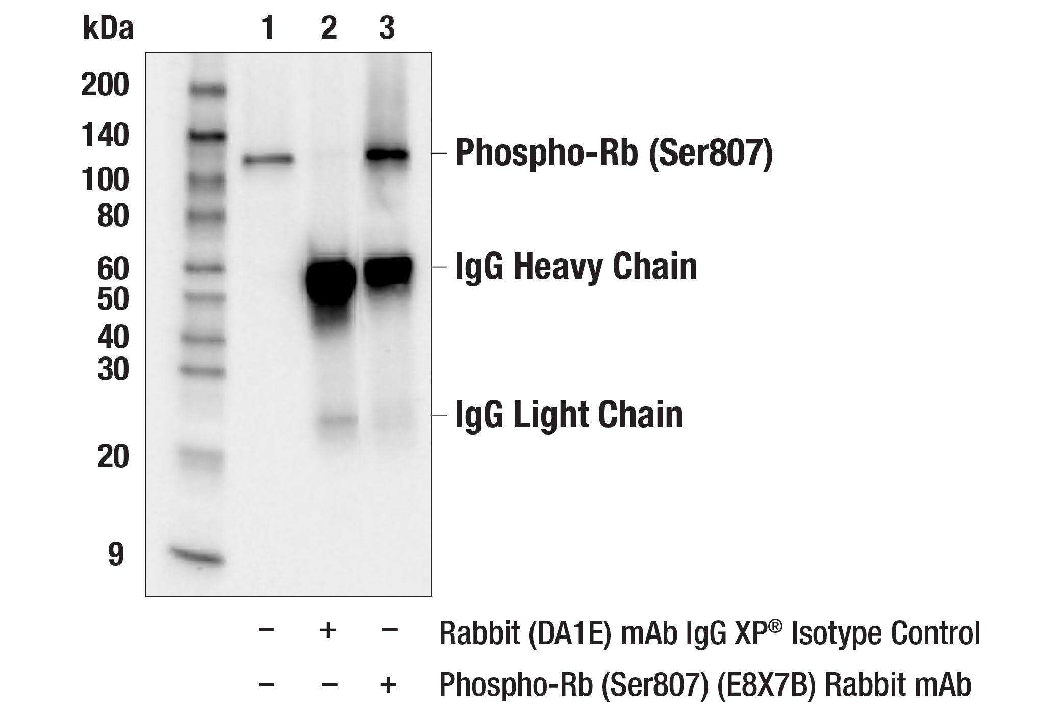 Immunoprecipitation Image 1: Phospho-Rb (Ser807) (E8X7B) Rabbit mAb