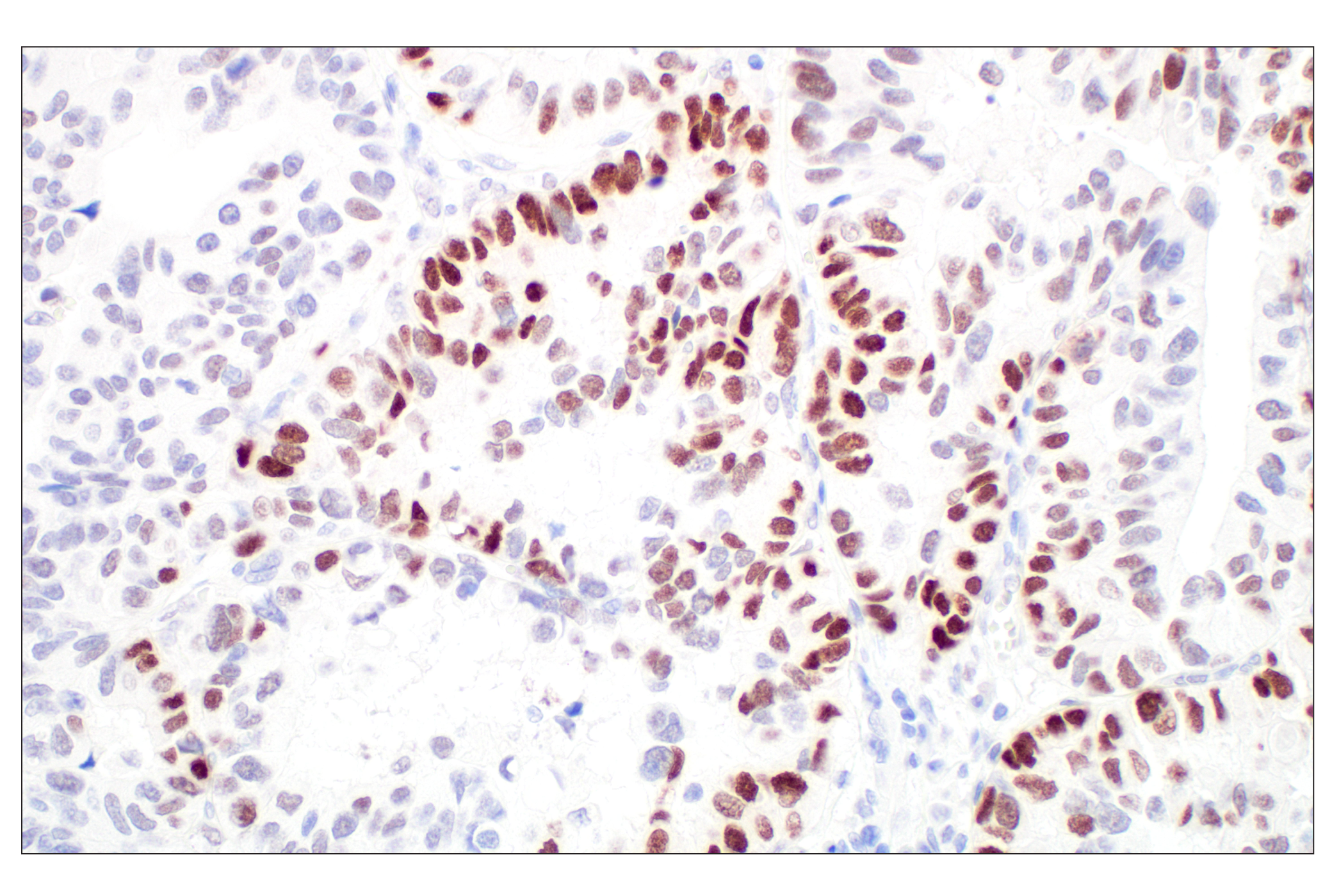 Immunohistochemistry Image 1: GATA-2 (E8B5C) Rabbit mAb