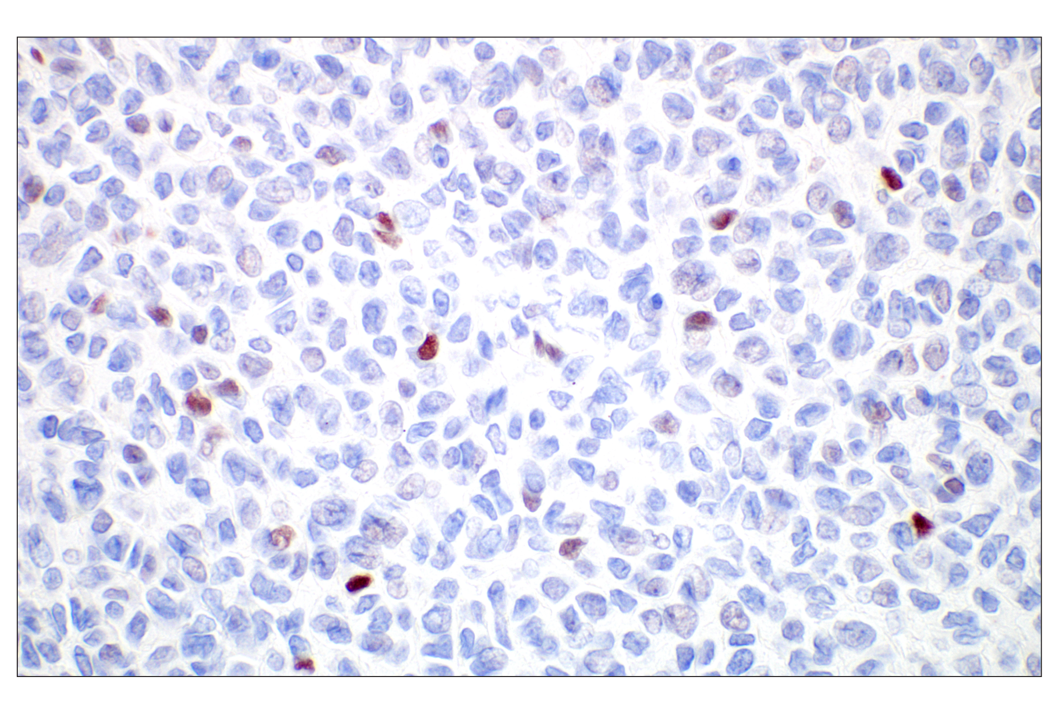 Immunohistochemistry Image 2: GATA-2 (E8B5C) Rabbit mAb