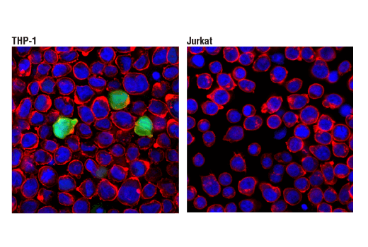 Immunofluorescence Image 1: S100A9 (D5O6O) Rabbit mAb
