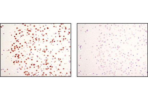 Immunohistochemistry Image 2: MeCP2 (D4F3) XP® Rabbit mAb (BSA and Azide Free)