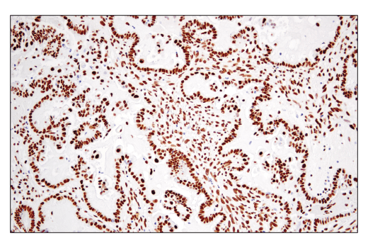 Immunohistochemistry Image 5: PTBP1 (E5O2S) Rabbit mAb