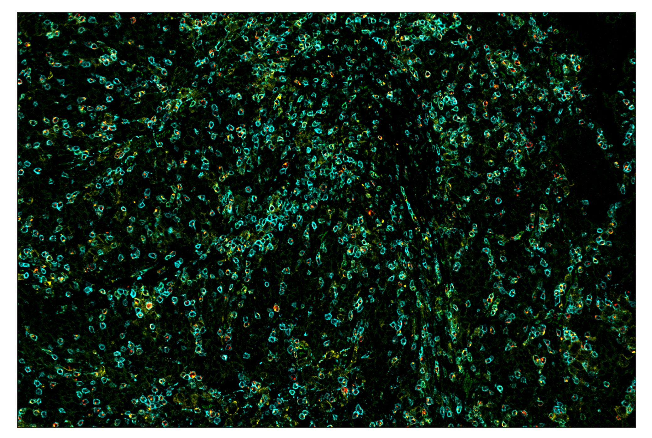 Immunohistochemistry Image 6: PD-1 (Intracellular Domain) (D4W2J) & CO-0008-594 SignalStar™ Oligo-Antibody Pair