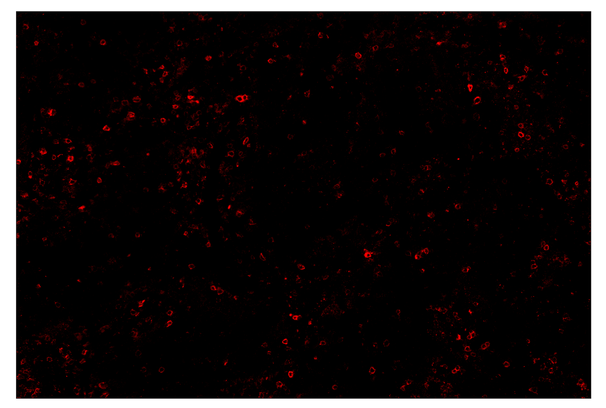 Immunohistochemistry Image 4: PD-1 (Intracellular Domain) (D4W2J) & CO-0008-594 SignalStar™ Oligo-Antibody Pair
