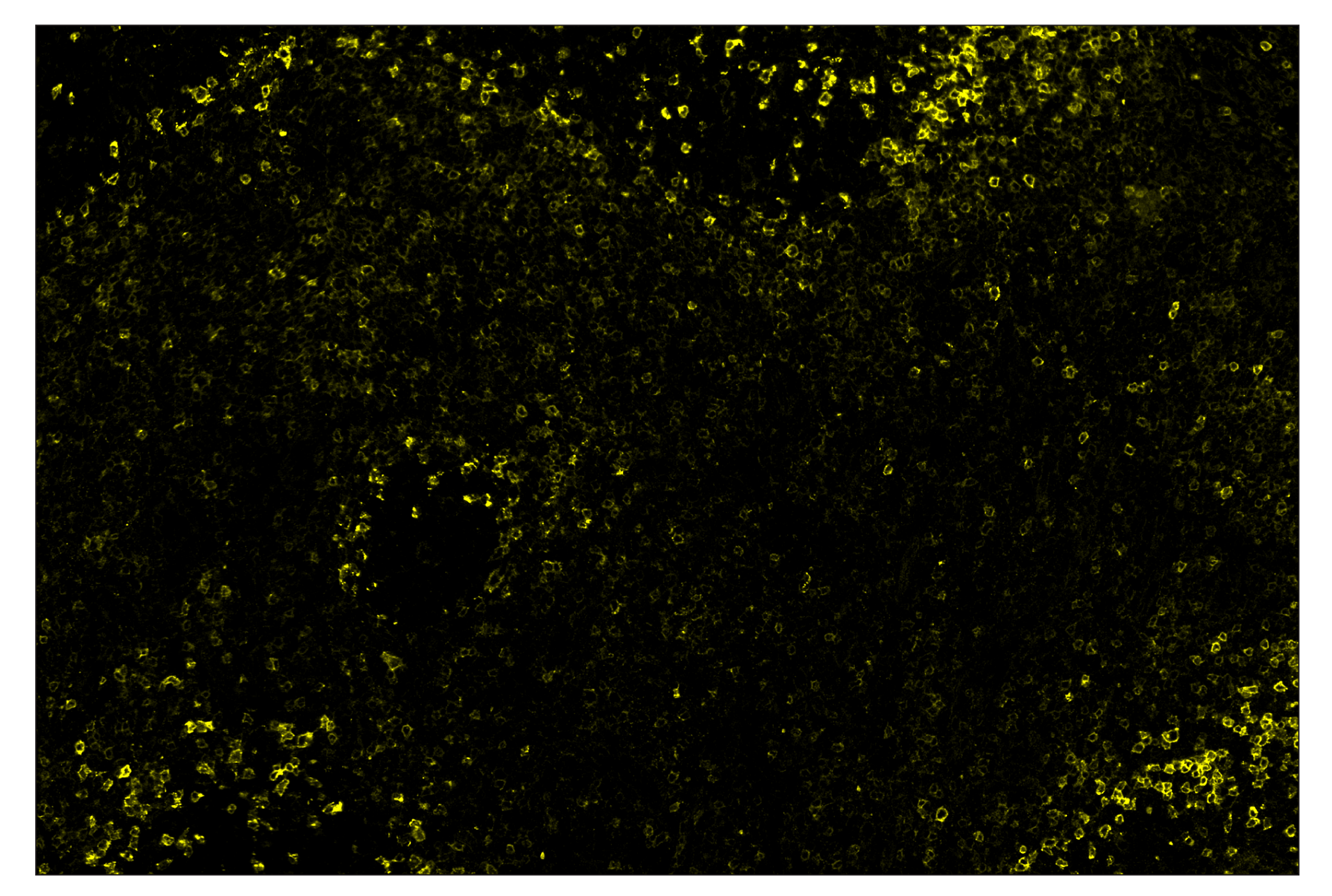 Immunohistochemistry Image 3: PD-1 (Intracellular Domain) (D4W2J) & CO-0008-594 SignalStar™ Oligo-Antibody Pair