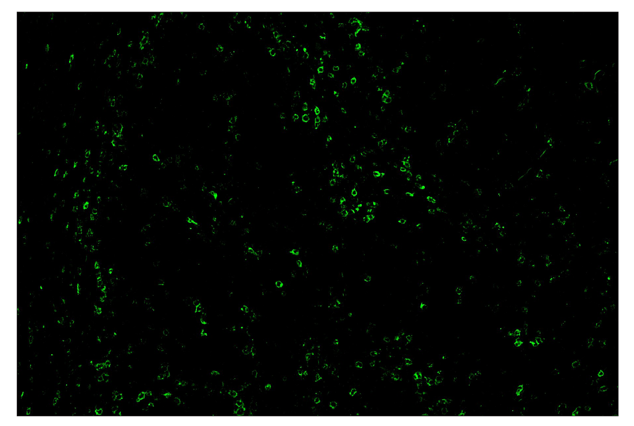 Immunohistochemistry Image 2: PD-1 (Intracellular Domain) (D4W2J) & CO-0008-647 SignalStar™ Oligo-Antibody Pair