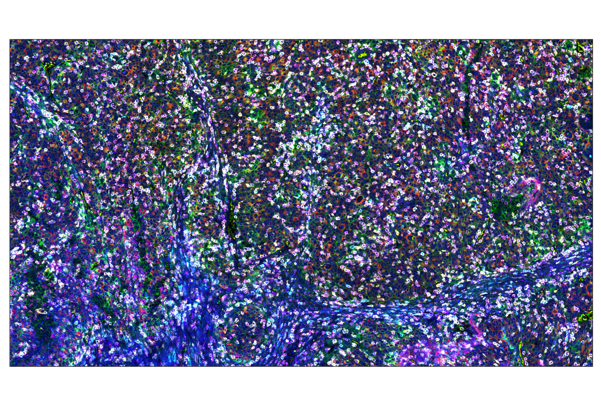 Immunohistochemistry Image 1: PD-1 (Intracellular Domain) (D4W2J) & CO-0008-647 SignalStar™ Oligo-Antibody Pair
