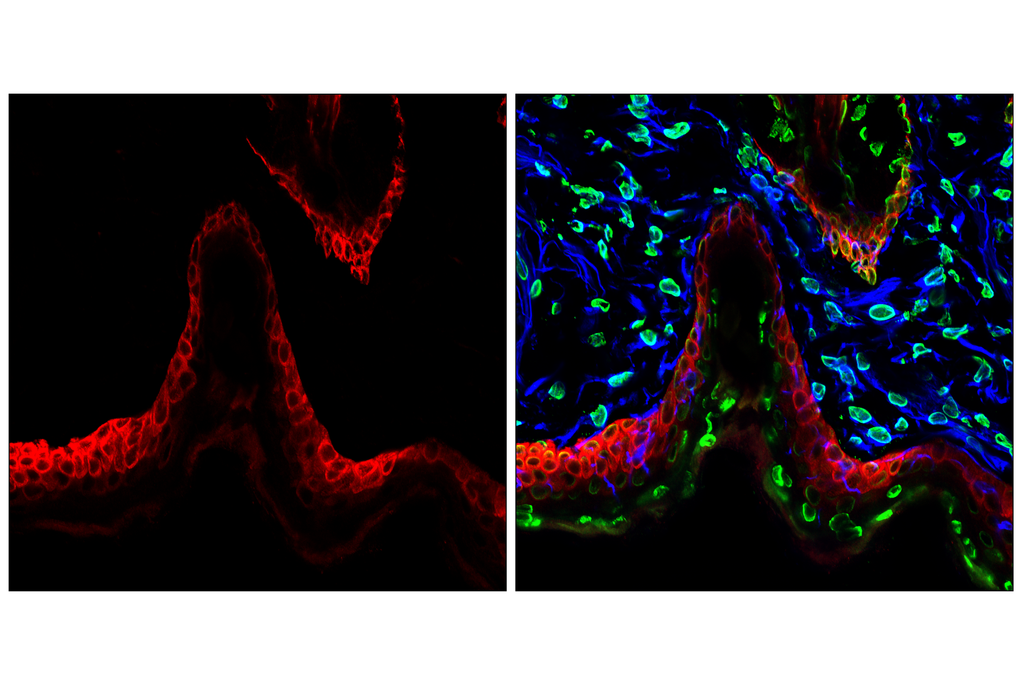 Immunofluorescence Image 1: Keratin 5 (E2T4B) XP® Rabbit mAb (Alexa Fluor® 555 Conjugate)