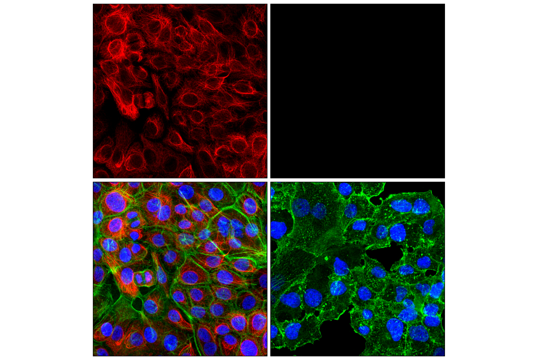 Immunofluorescence Image 2: Keratin 5 (E2T4B) XP® Rabbit mAb (Alexa Fluor® 555 Conjugate)
