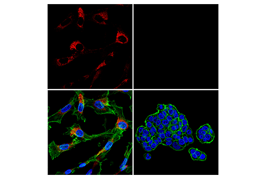 Immunofluorescence Image 4: COL1A1 (E8F4L) XP® Rabbit mAb (Alexa Fluor® 647 Conjugate)