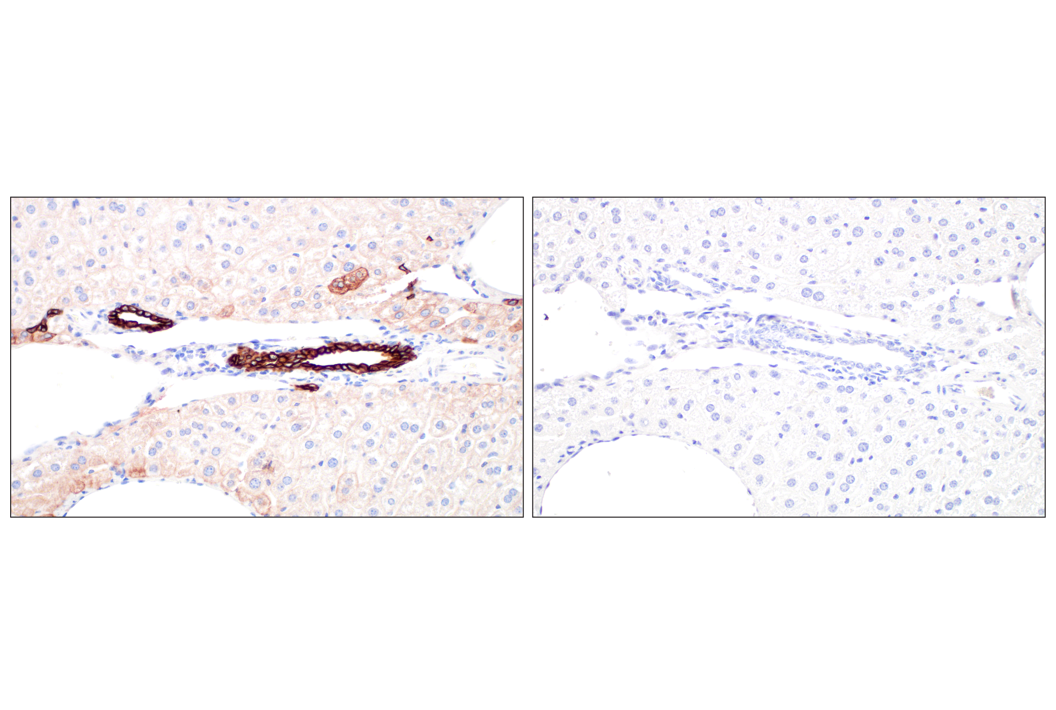 Immunohistochemistry Image 13: Pan-Keratin (Type I) (E6S1S) Rabbit mAb (BSA and Azide Free)