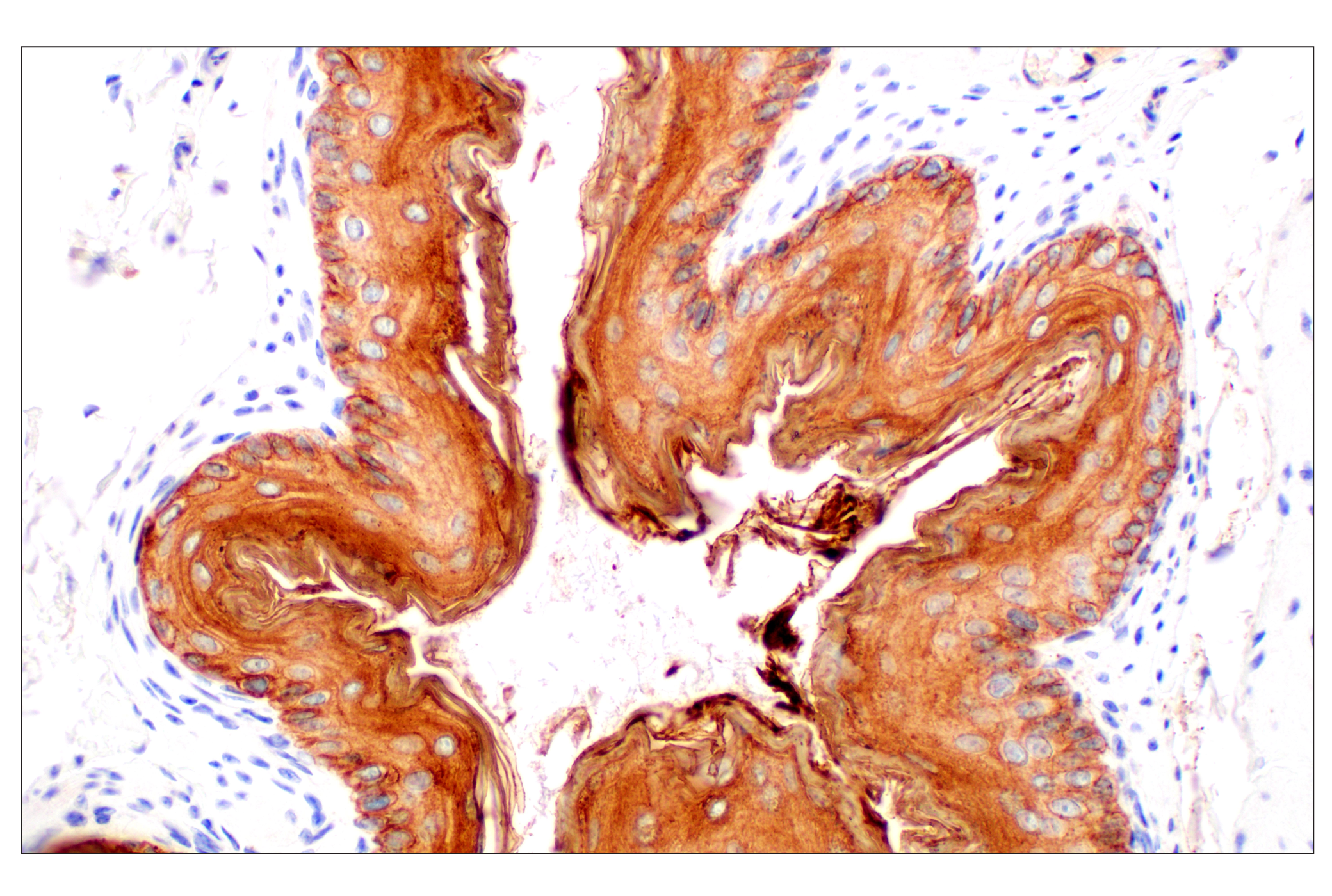 Immunohistochemistry Image 11: Pan-Keratin (Type I) (E6S1S) Rabbit mAb (BSA and Azide Free)