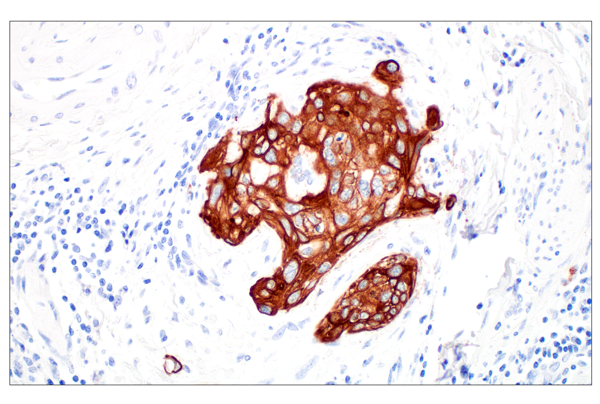 Immunohistochemistry Image 6: Pan-Keratin (Type I) (E6S1S) Rabbit mAb (BSA and Azide Free)