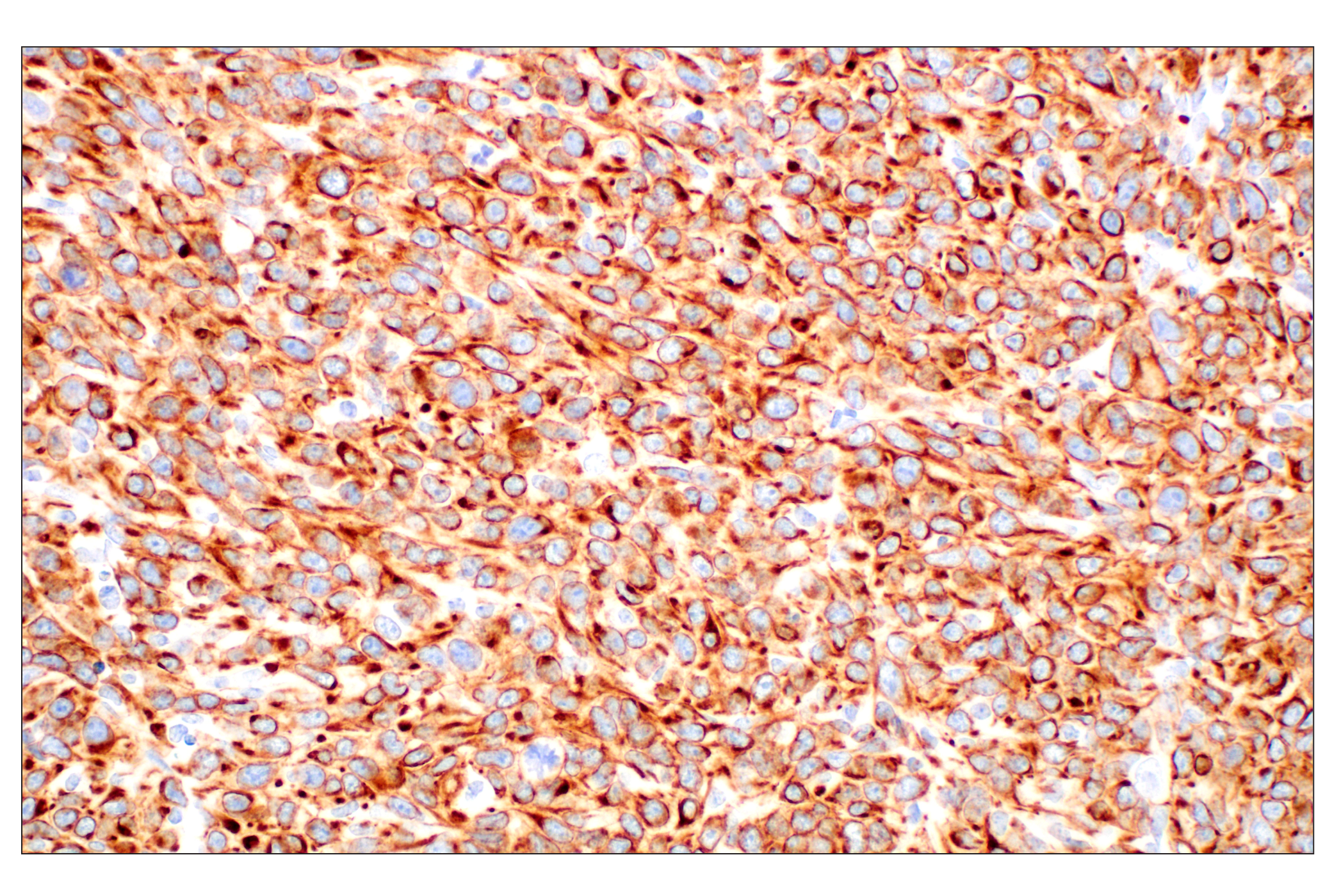 Immunohistochemistry Image 10: Pan-Keratin (Type I) (E6S1S) Rabbit mAb (BSA and Azide Free)