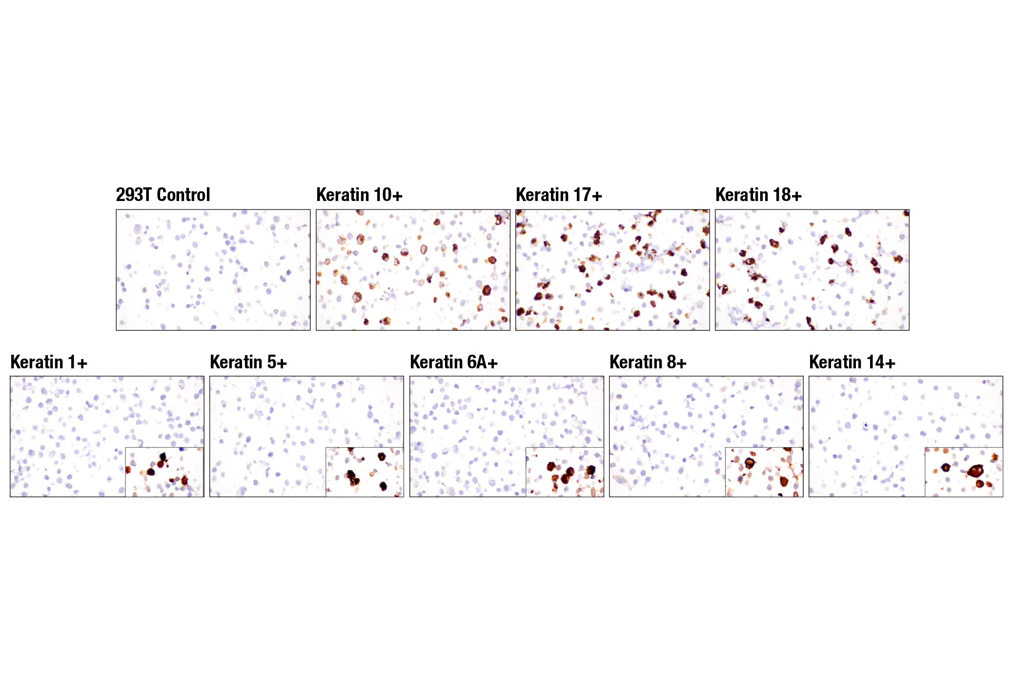 Immunohistochemistry Image 14: Pan-Keratin (Type I) (E6S1S) Rabbit mAb (BSA and Azide Free)