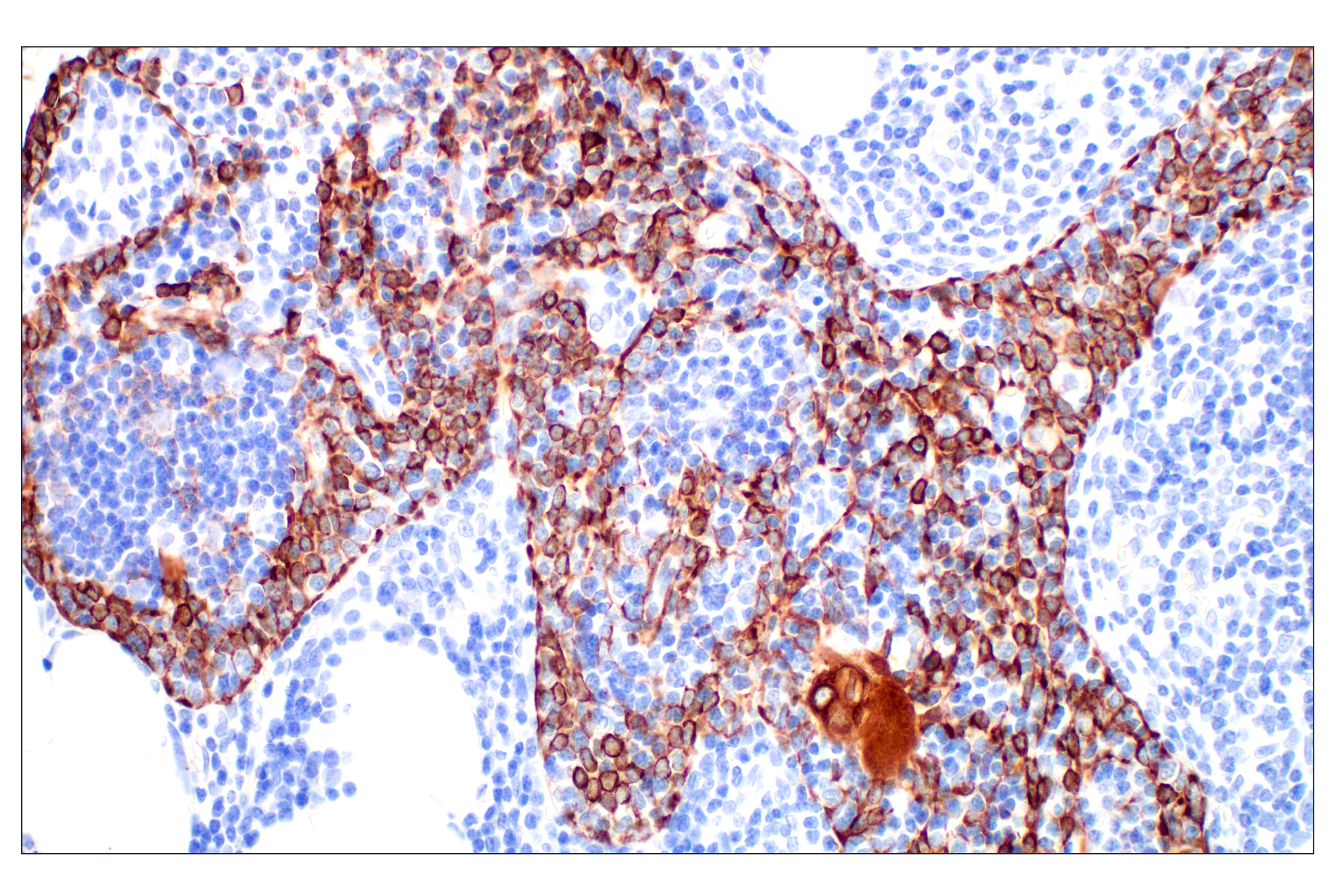 Immunohistochemistry Image 8: Pan-Keratin (Type I) (E6S1S) Rabbit mAb (BSA and Azide Free)