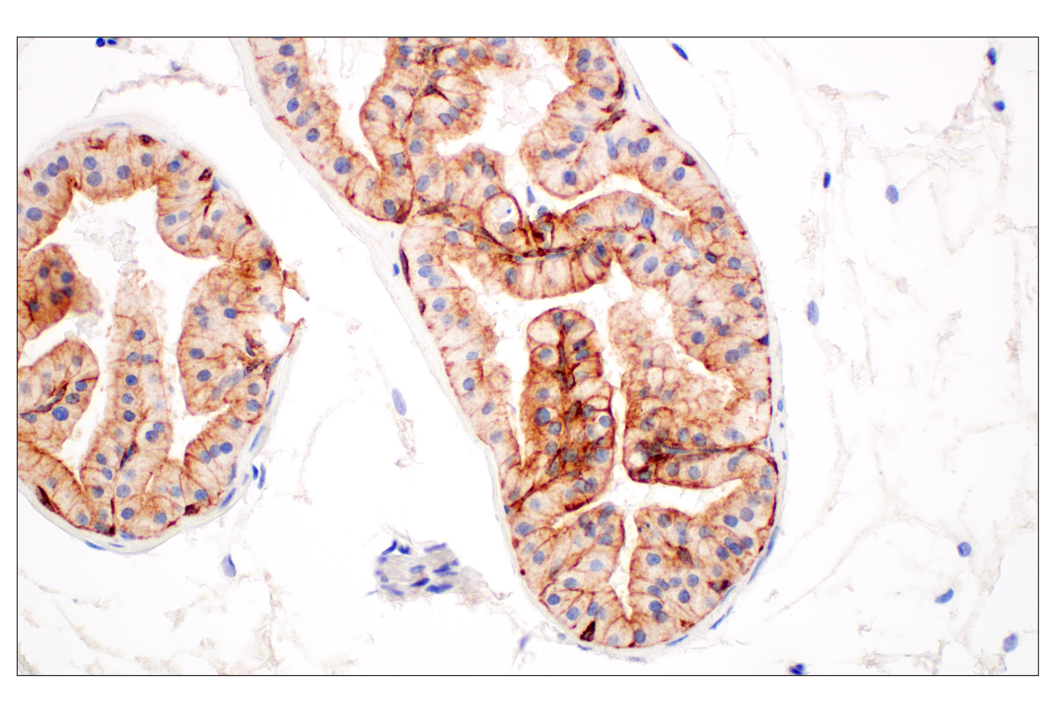 Immunohistochemistry Image 12: Pan-Keratin (Type I) (E6S1S) Rabbit mAb (BSA and Azide Free)