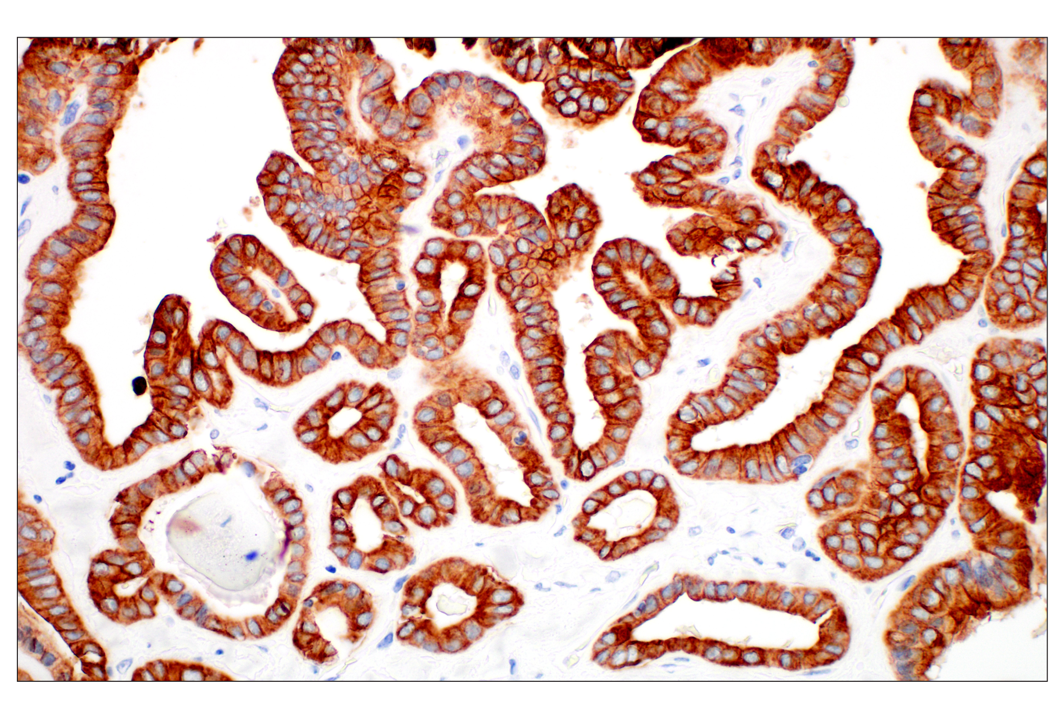 Immunohistochemistry Image 5: Pan-Keratin (Type I) (E6S1S) Rabbit mAb (BSA and Azide Free)