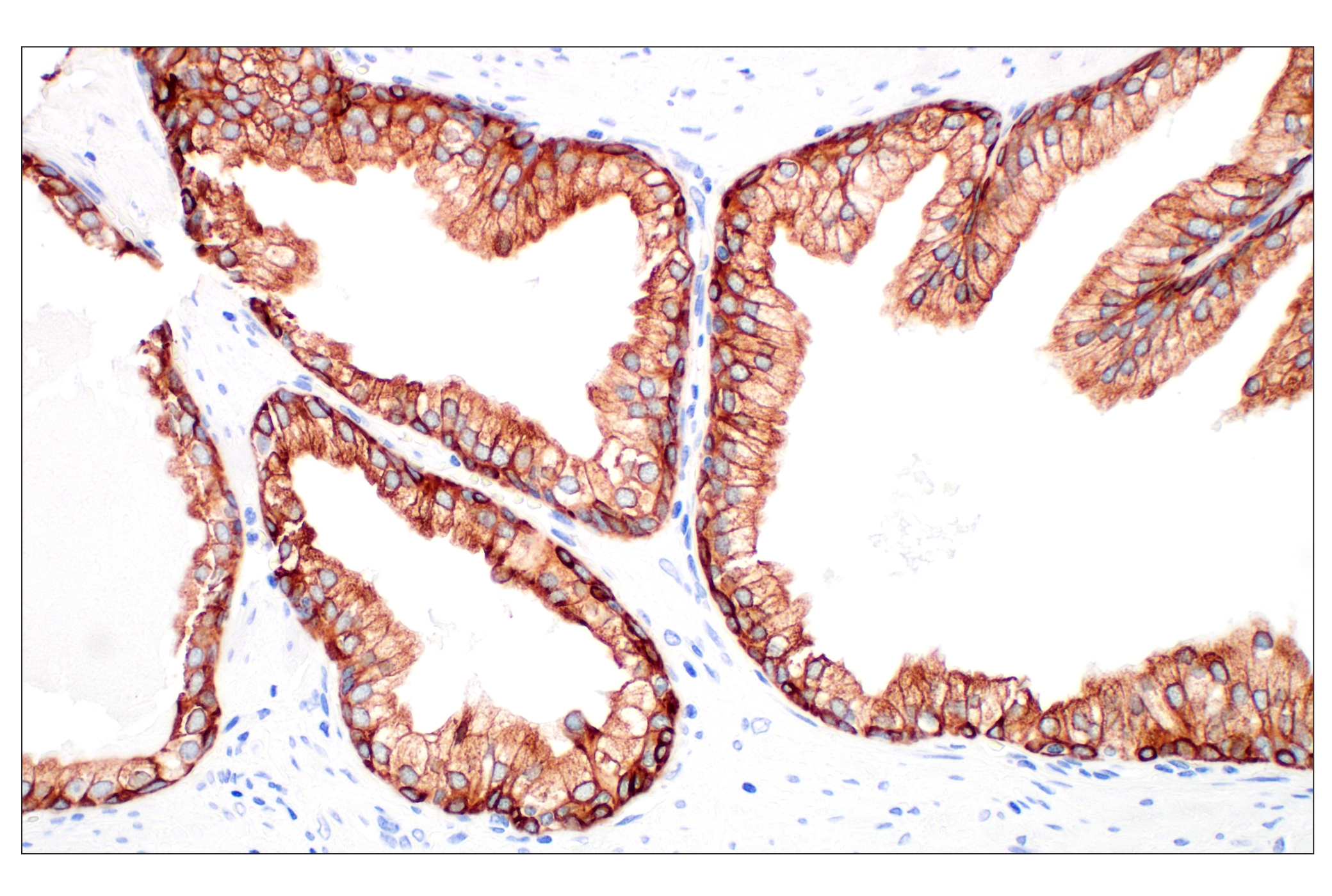 Immunohistochemistry Image 4: Pan-Keratin (Type I) (E6S1S) Rabbit mAb (BSA and Azide Free)
