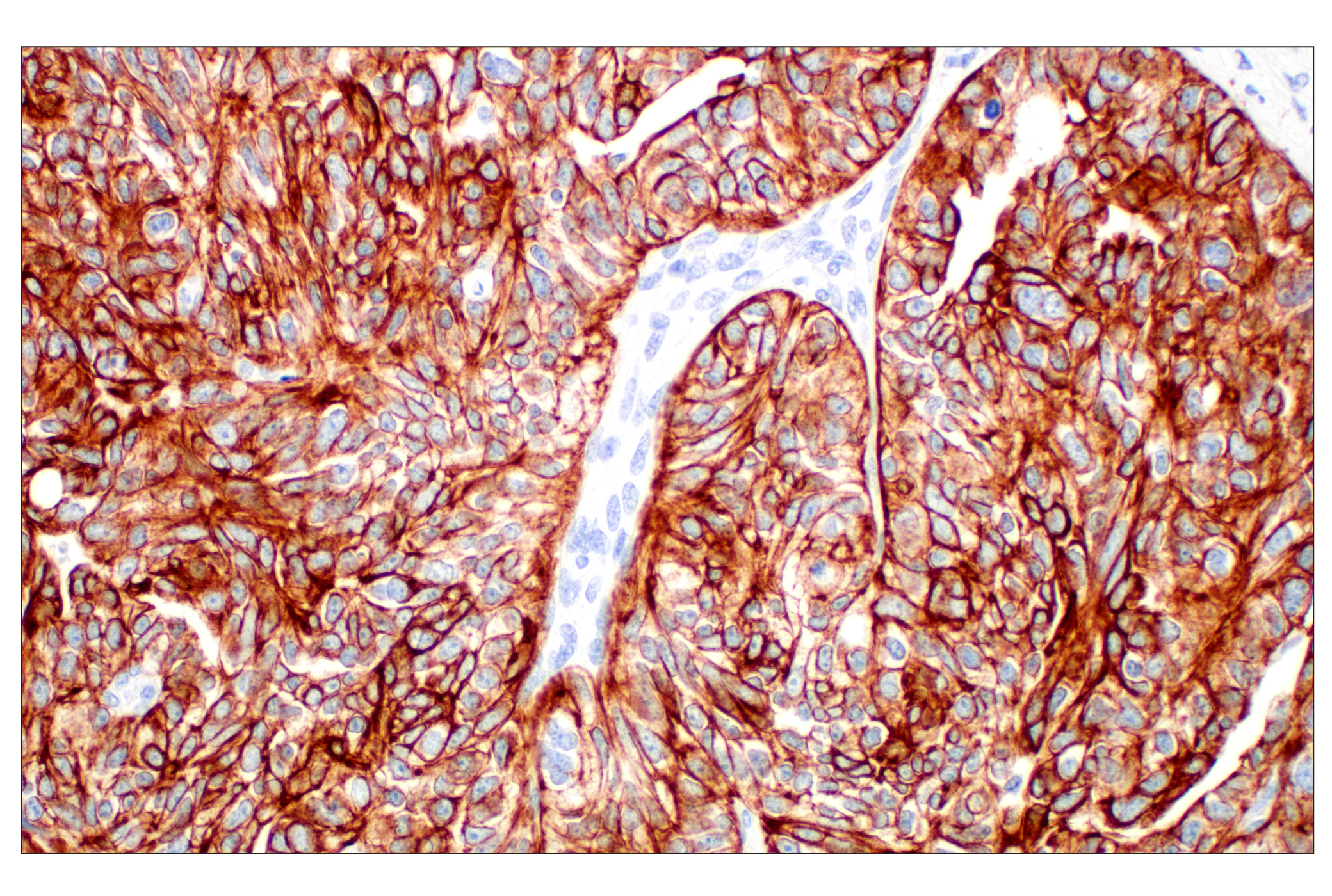 Immunohistochemistry Image 1: Pan-Keratin (Type I) (E6S1S) Rabbit mAb (BSA and Azide Free)