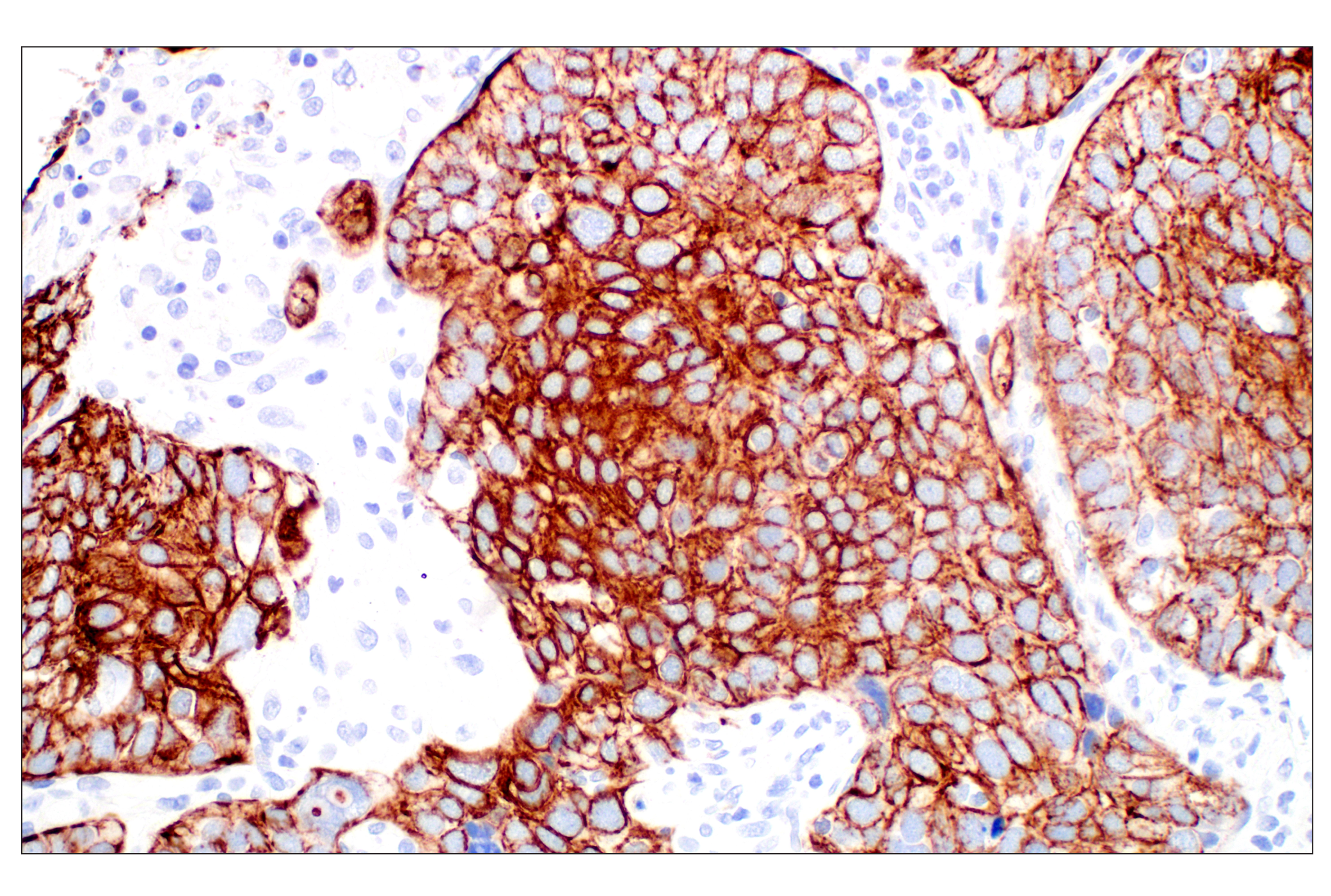 Immunohistochemistry Image 3: Pan-Keratin (Type I) (E6S1S) Rabbit mAb (BSA and Azide Free)