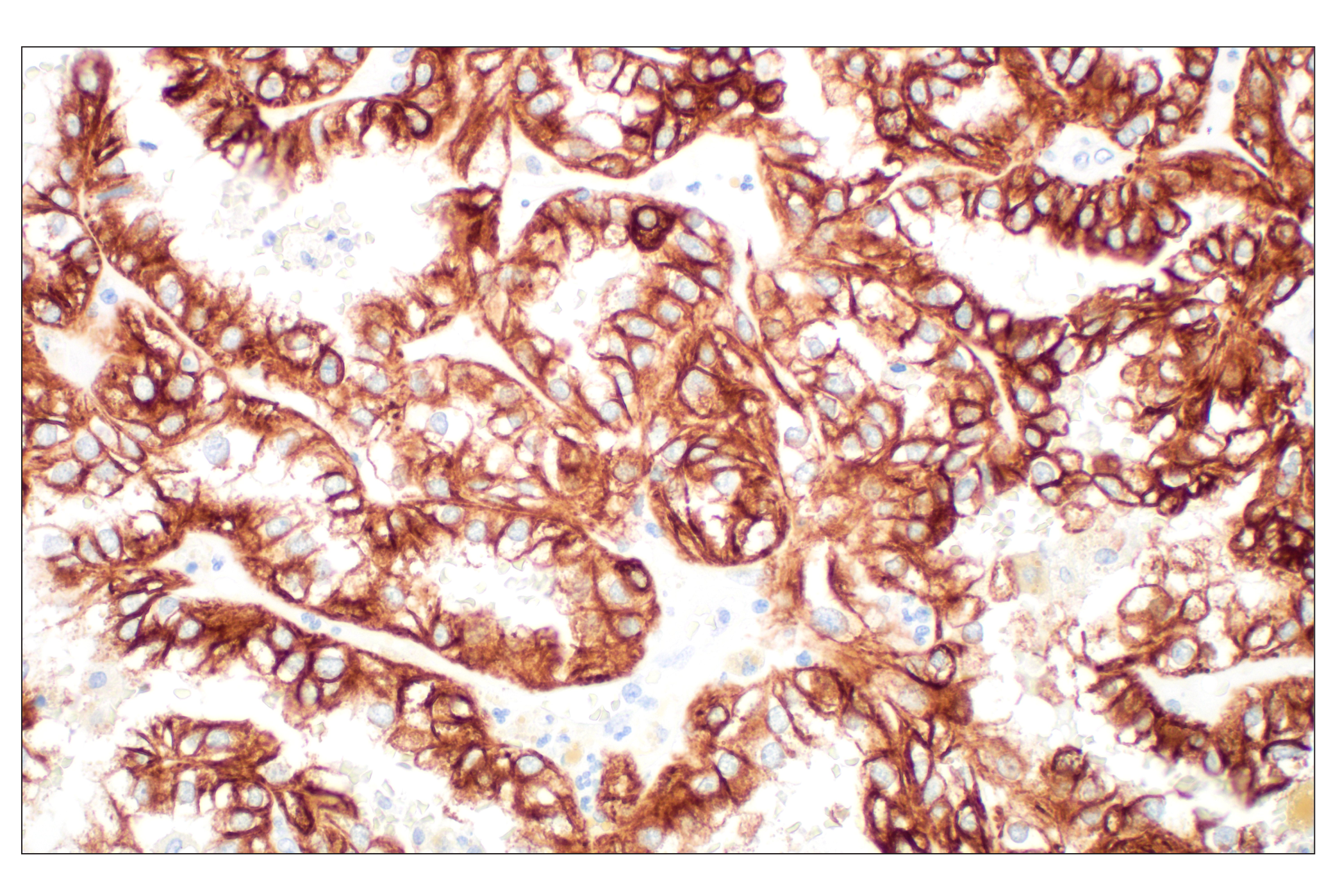 Immunohistochemistry Image 2: Pan-Keratin (Type I) (E6S1S) Rabbit mAb (BSA and Azide Free)