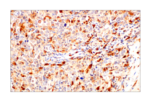 Immunohistochemistry Image 1: SignalStain® Boost IHC Detection Reagent (HRP, Rat)