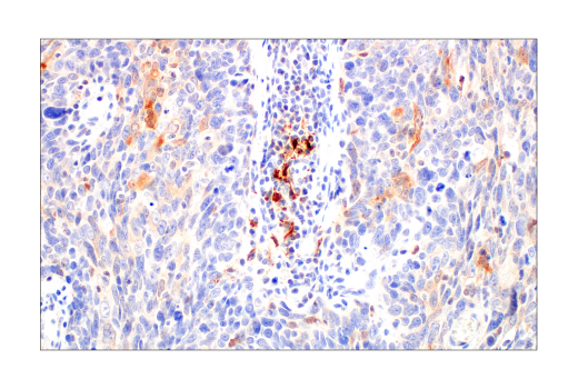 Immunohistochemistry Image 2: SignalStain® Boost IHC Detection Reagent (HRP, Rat)