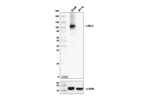 Western Blotting Image 1: LOXL2 (E3P7Y) Rabbit mAb (BSA and Azide Free)