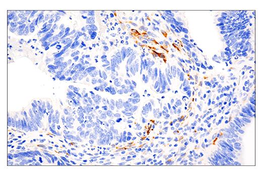 Immunohistochemistry Image 1: LOXL2 (E3P7Y) Rabbit mAb (BSA and Azide Free)