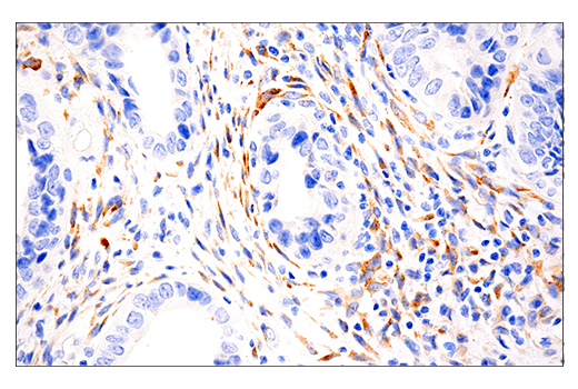 Immunohistochemistry Image 2: LOXL2 (E3P7Y) Rabbit mAb (BSA and Azide Free)
