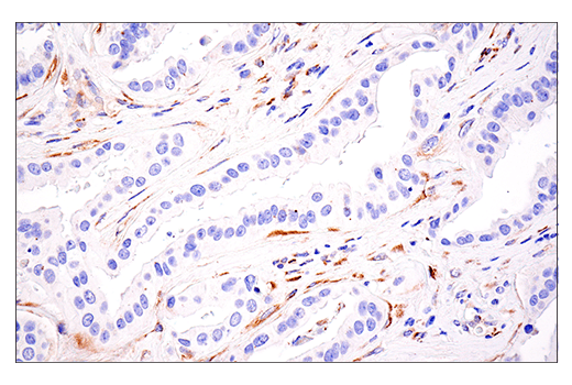 Immunohistochemistry Image 3: LOXL2 (E3P7Y) Rabbit mAb (BSA and Azide Free)