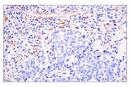 Immunohistochemistry Image 5: LOXL2 (E3P7Y) Rabbit mAb (BSA and Azide Free)