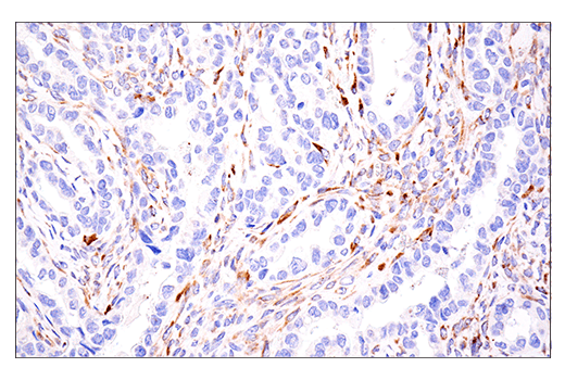 Immunohistochemistry Image 6: LOXL2 (E3P7Y) Rabbit mAb (BSA and Azide Free)