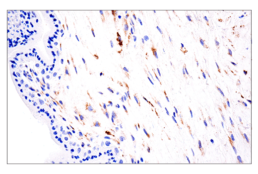 Immunohistochemistry Image 7: LOXL2 (E3P7Y) Rabbit mAb (BSA and Azide Free)