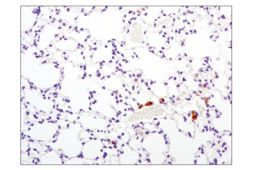 Immunohistochemistry Image 4: TIM-3 (D3M9R) XP® Rabbit mAb (Mouse Specific) (BSA and Azide Free)