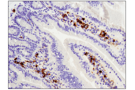Immunohistochemistry Image 1: TIM-3 (D3M9R) XP® Rabbit mAb (Mouse Specific) (BSA and Azide Free)