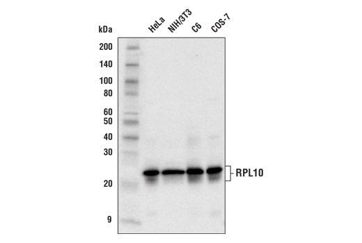 Western Blotting Image 1: RPL10 Antibody