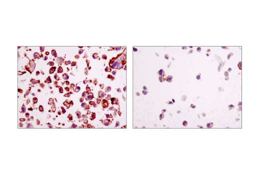 Immunohistochemistry Image 2: Integrin β1 (D2E5) Rabbit mAb (BSA and Azide Free)