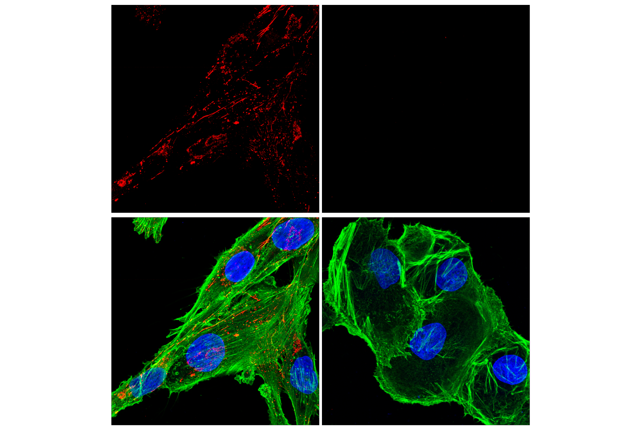 Immunofluorescence Image 1: Fibronectin/FN1 (E5H6X) Rabbit mAb (Alexa Fluor® 647 Conjugate)