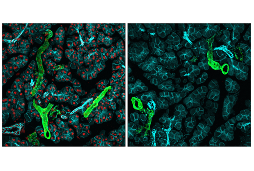 Immunofluorescence Image 1: CTCF (D31H2) XP® Rabbit mAb (Alexa Fluor® 555 Conjugate)