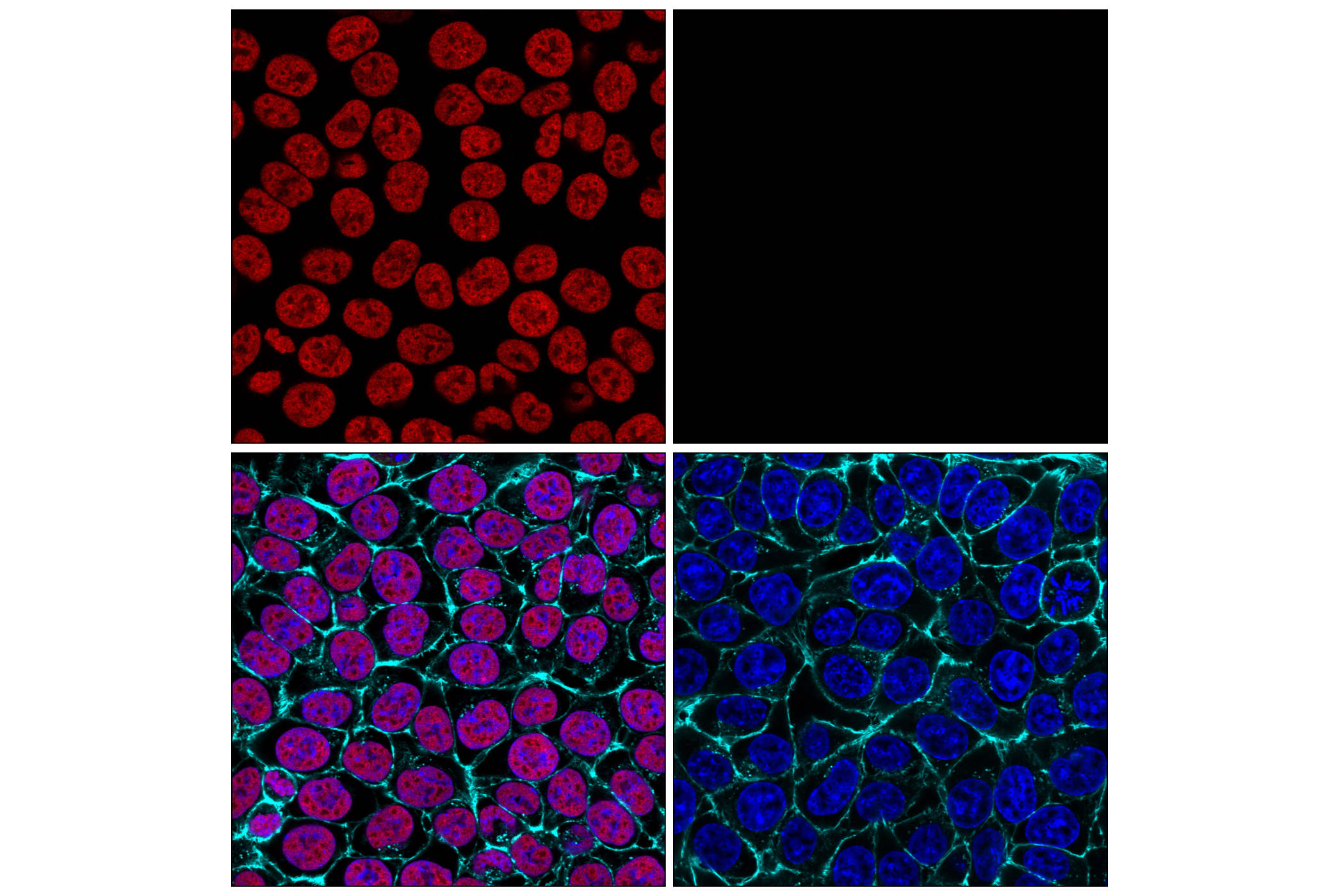 Immunofluorescence Image 2: CTCF (D31H2) XP® Rabbit mAb (Alexa Fluor® 555 Conjugate)
