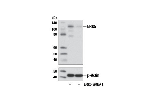  Image 1: SignalSilence® ERK5 siRNA I