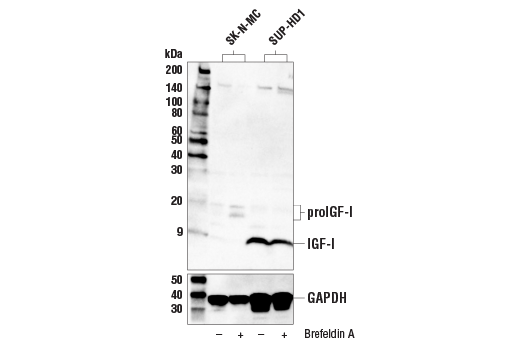  Image 8: Cancer-associated Growth Factor Antibody Sampler Kit