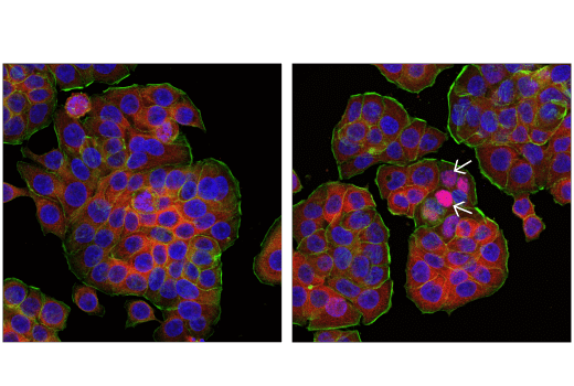 Immunofluorescence Image 1: IRF-3 (D9J5Q) Mouse mAb (Alexa Fluor® 555 Conjugate)